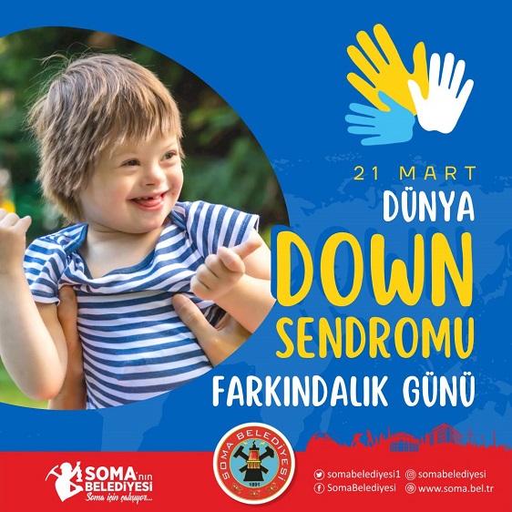 Down Sendromu, tedavi edilmesi gereken bir hastalık değil, genetik bir farklılıktır.